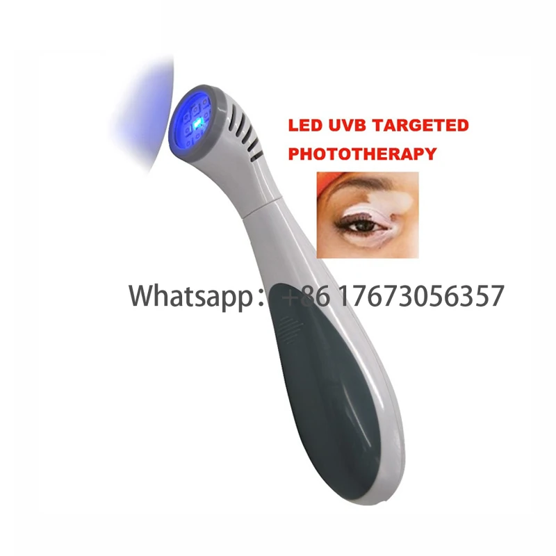 Otthoni Használatra UV Lámpa Vitiligo UVB Fényterápia A Psoriasis